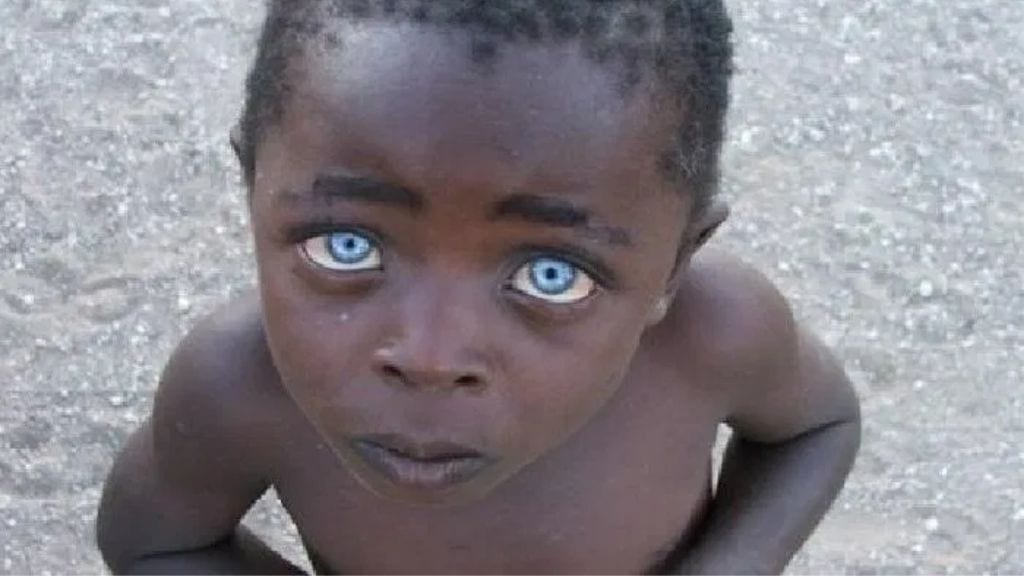 Kadealo, Blue Eyes, Why is it Possible